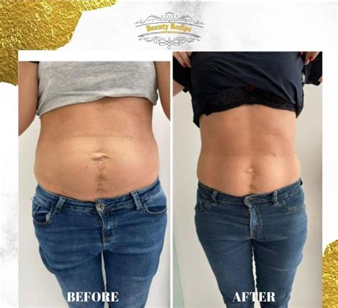 ems weight loss results|How to Get Fit Using Electrical Muscle Stimulation (EMS).